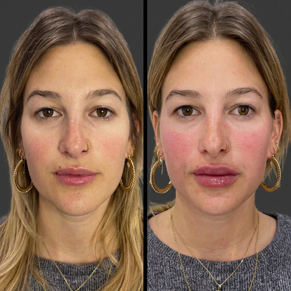 TrueLips Serum Exclusive